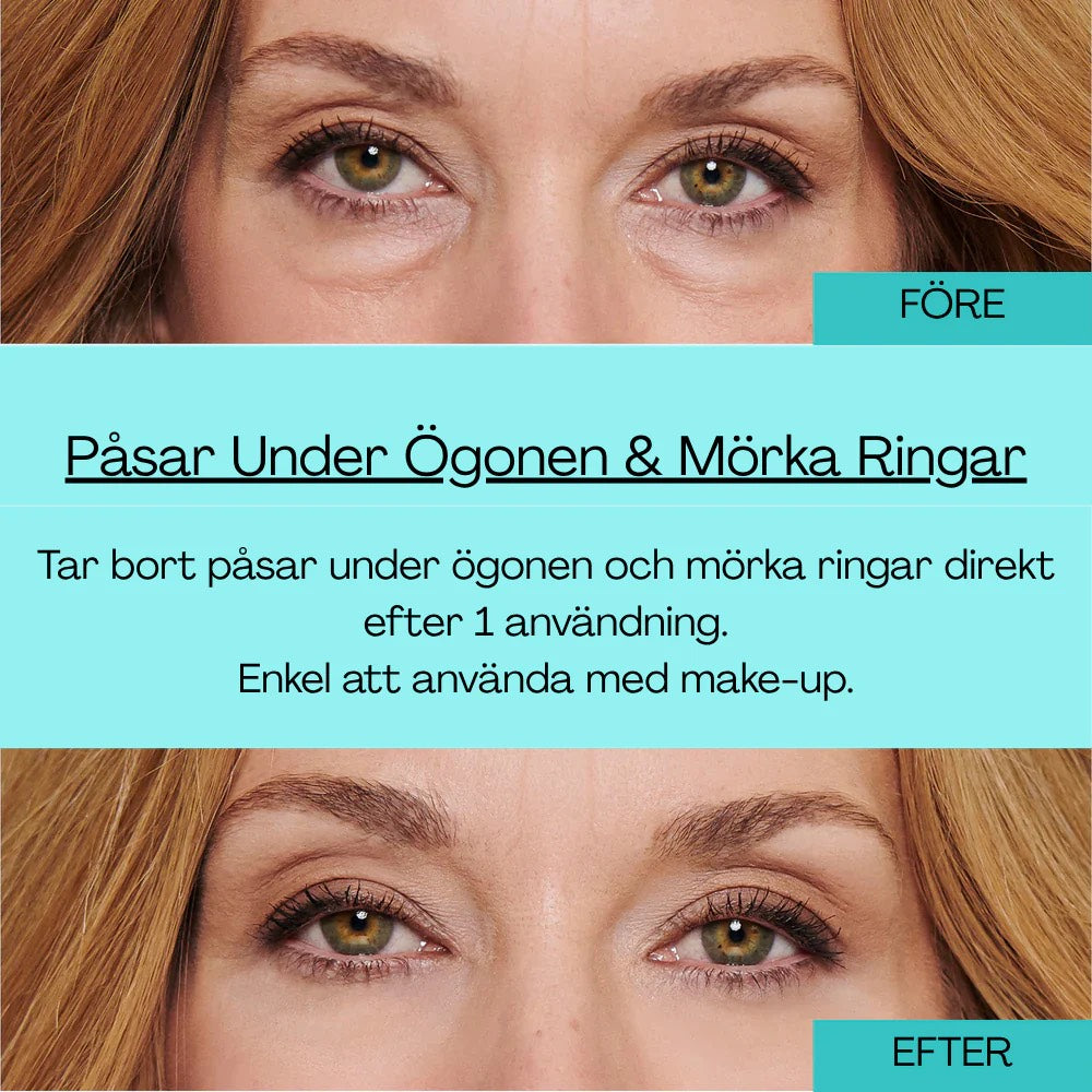 BrightUp™ - Eliminerar ögonpåsar & rynkor 👁✨