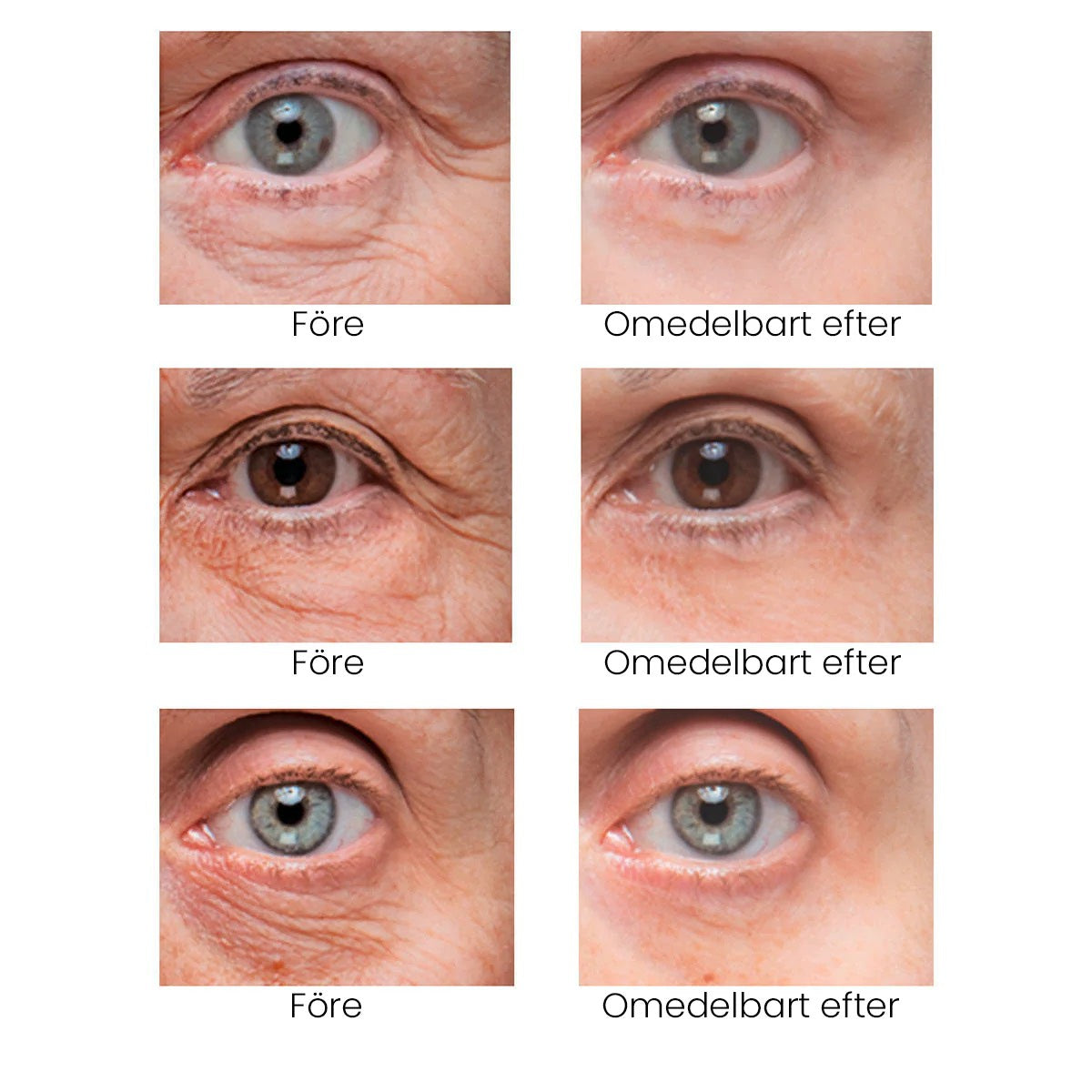 BrightUp™ - Eliminerar ögonpåsar & rynkor 👁✨